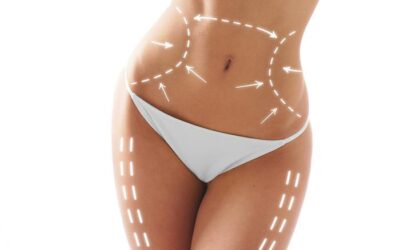 Slimming Down Your Midsection With A Tummy Tuck