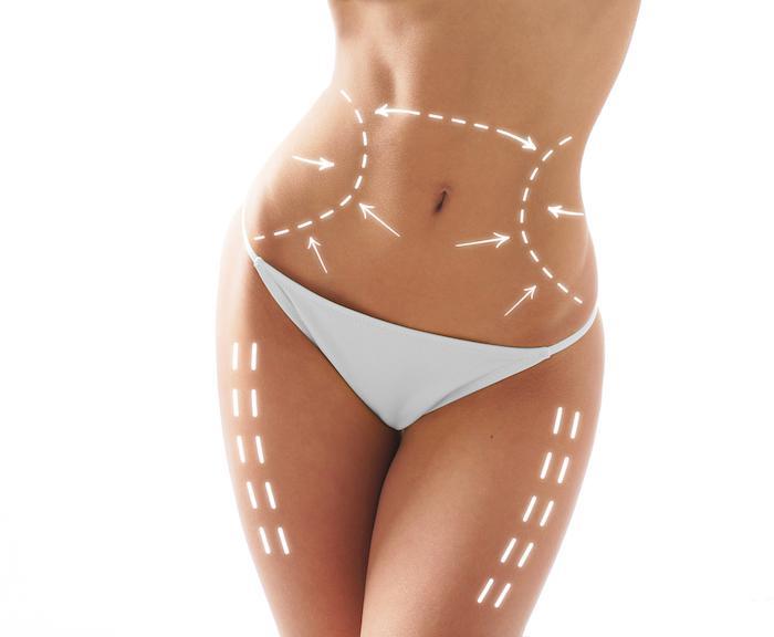 Slimming Down Your Midsection With A Tummy Tuck