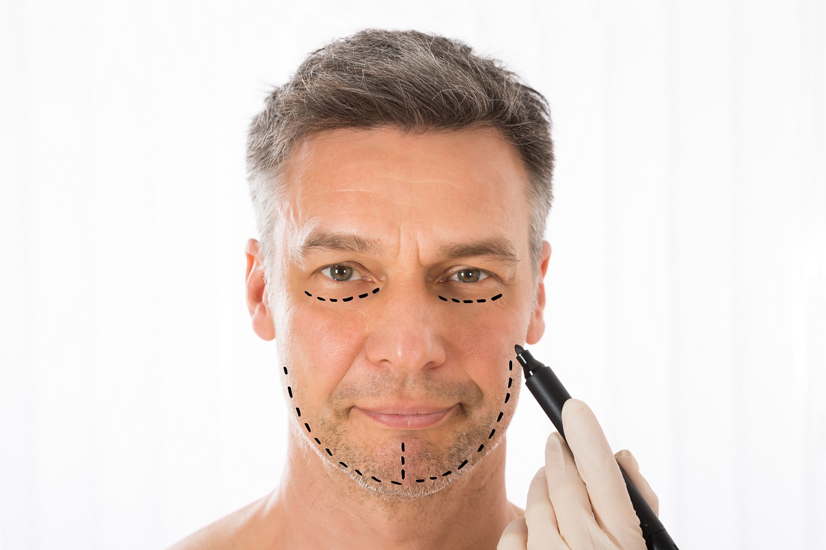 Surgeon Hands Drawing Correction Lines On Man Face With Marker