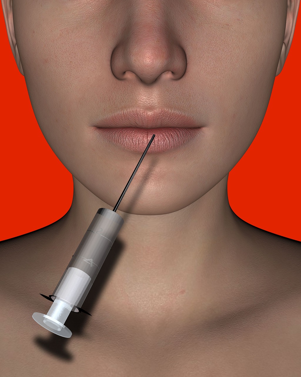 Lip augmentation procedure