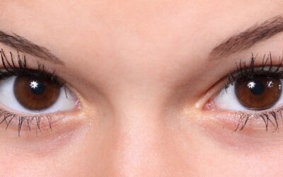 What Is Blepharoplasty?