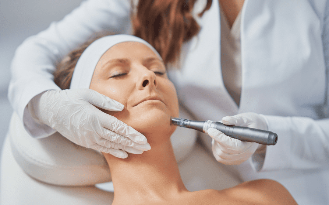 The Benefits of Microneedling: How It Works and Why You Should Try It