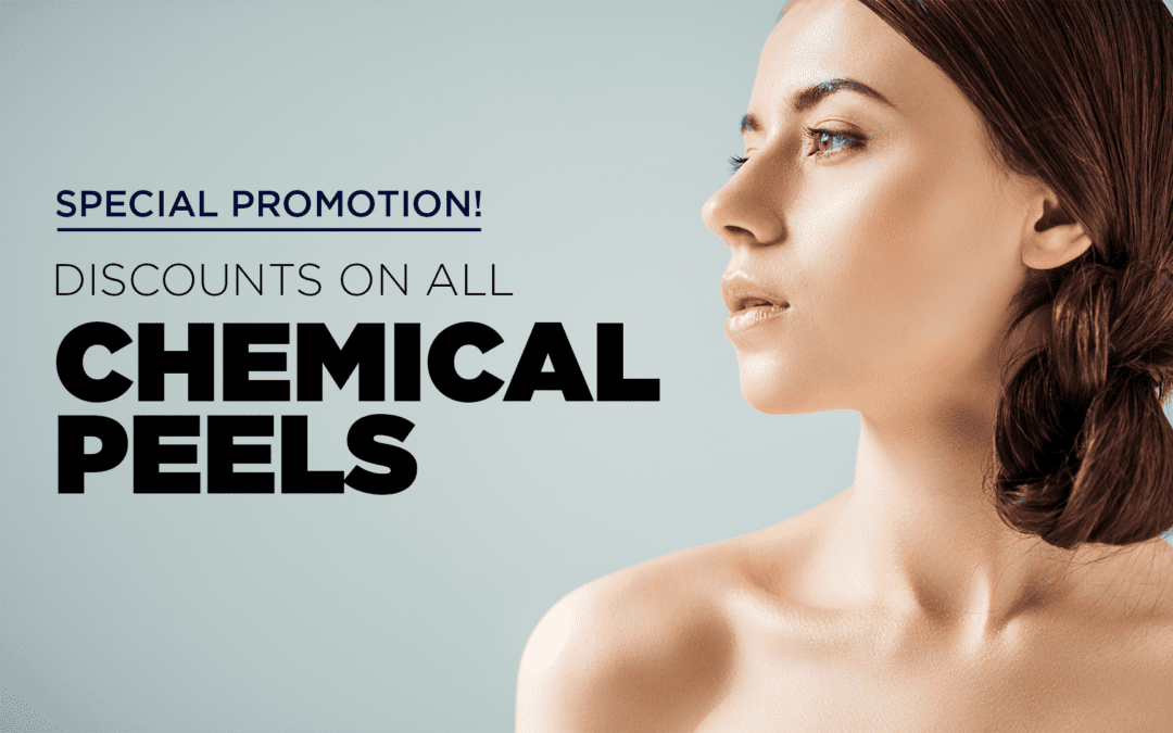 Deals on Chemical Peels